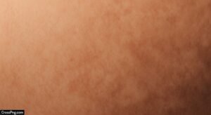 Skin colour background image